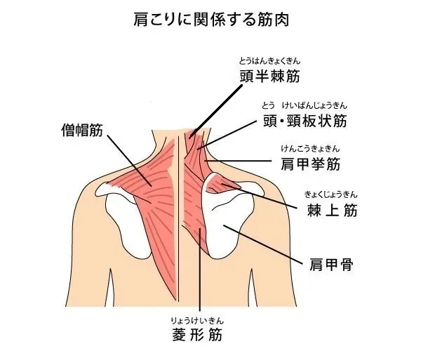 帯広の整骨院が肩こりの予防を徹底解説